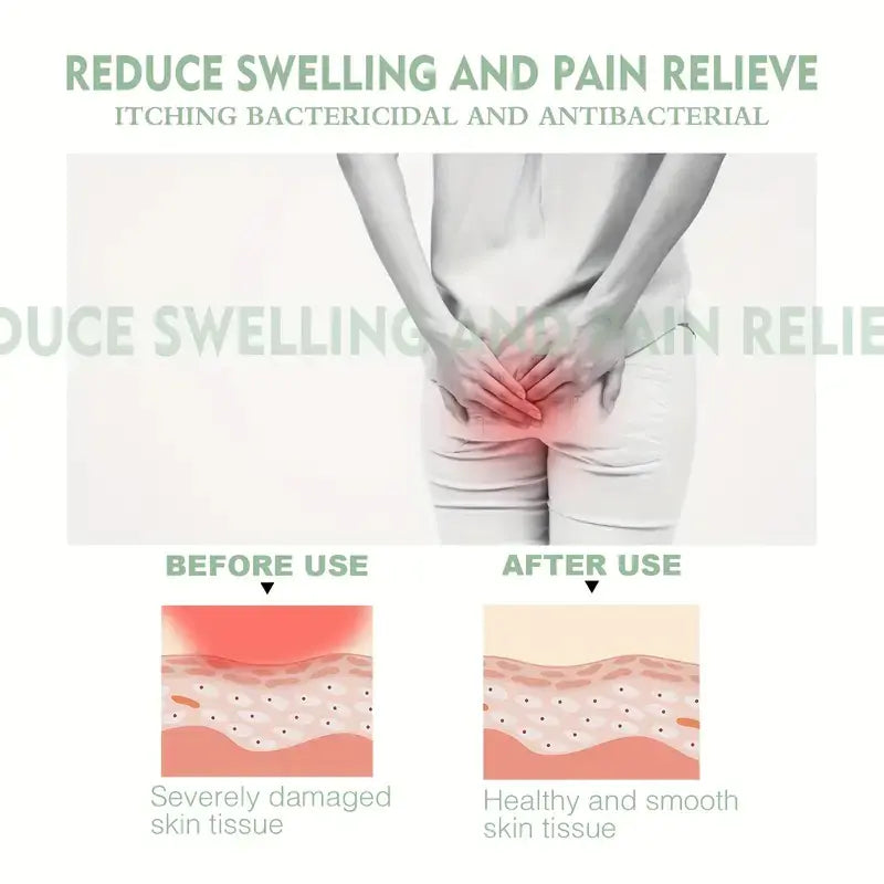Hemorrhoids Relief Cream for Pain and Itching Relief